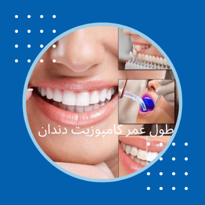 طول عمر کامپوزیت دندان